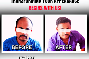 D.R. Hair Transplantation image