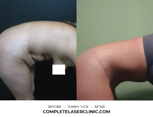 Explore love yourz tattoo ideas, creative tattoo ideas in Mooresville, available at Complete Laser Clinic - Mooresville