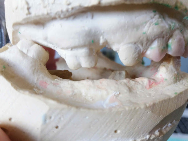 Αξιολογήσεις για το Οδοντιατρείο Τζελήλ Ζερρίν στην Καβάλα - Οδοντίατρος