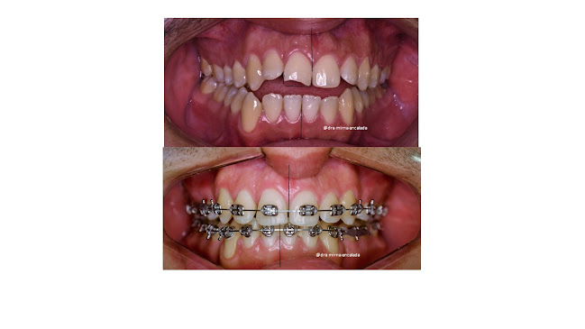 ORTOIMPLANT MACHALA ECUADOR. Ortodoncista e Implantóloga Oral. Dra. Mirna Encalada - Dentista