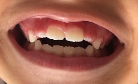 Consultório Odontológico Smile Essence ( Urgência, Harmonização Facial Prótese & Reabilitação Oral )