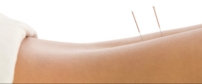 Audrey LAFORIE - Acupuncture traditionnelle chinoise et amaigrissement - ORTHEZ à Orthez