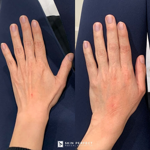 Explore christian tattoo ideas for women, creative tattoo ideas in Whittier, available at Skin Perfect Medical Aesthetics