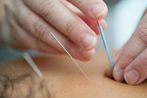 Kevin Kim Acupuncture (in Advanced Wellness Center)