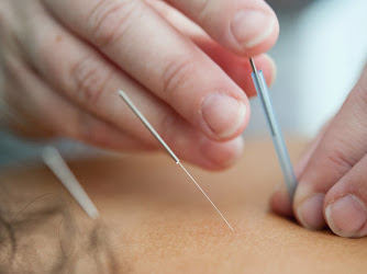Kevin Kim Acupuncture (in Advanced Wellness Center)
