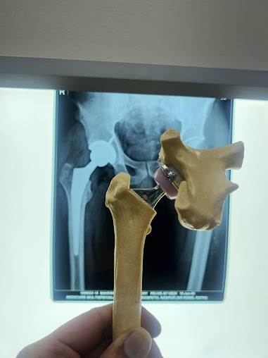 Knee and Hip Orthopaedic clinic by Dr. Romil Rathi - Knee and Hip Orthopaedic clinic by Dr. Romil Rathi