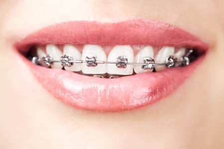 DentalEsp Morelia | Consultorio Dental | Dentista | Endodoncia | Ortodoncia