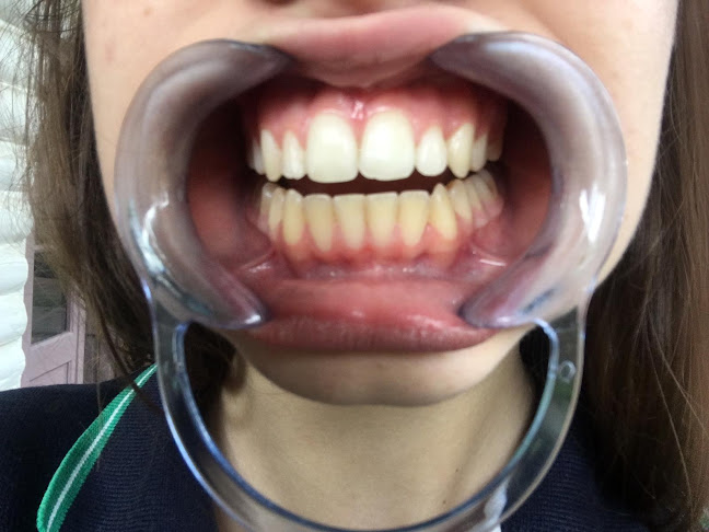 Opiniones de Dentista en El Pinar en Canelones - Dentista