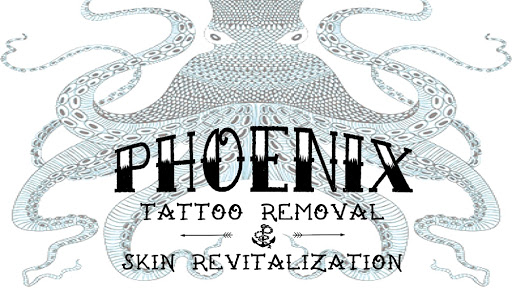 Phoenix Tattoo Removal and Skin Revitalization