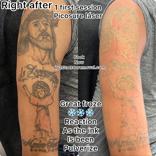 Explore motocross tattoo ideas, creative tattoo ideas in New York, available at Ag2g Laser Tattoo Removal & MedSpa