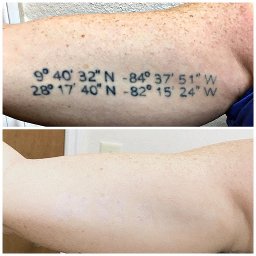 Explore thin blue line tattoo ideas, creative tattoo ideas in Pinellas Park, available at St Pete Tattoo Removal