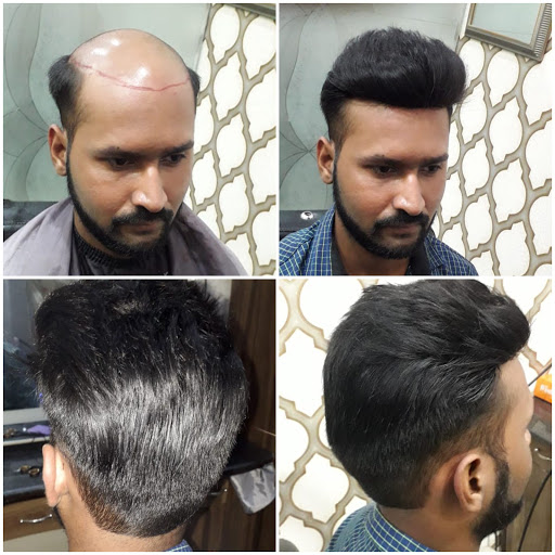 Best hair patch,Hair wigs in delhi,Wigs for cancer patients Men and Women  in India - Wig Shop in Karol Bagh