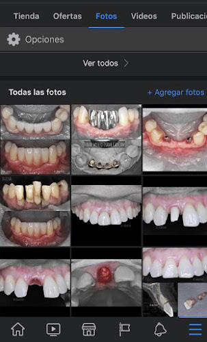 Horarios de Implantológica Osorno | Clínica dental de Implantología Oral, Stripcenter Las Quemas