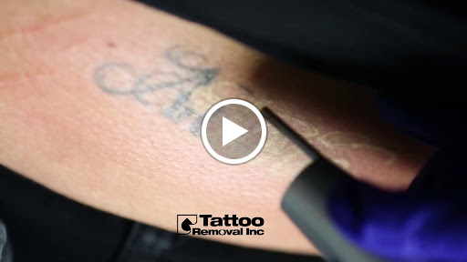 Explore tattoo placement ideas female, creative tattoo ideas in South Gate, available at Tattoo Removal Inc