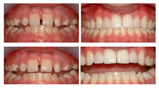 Prime Dental - Implants & Orthodontics in Wexford, Co. Wexford (Loch Garman)