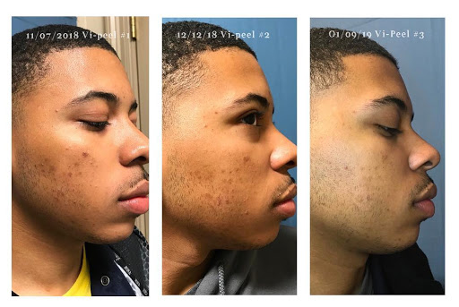 Explore back of hand tattoo ideas, creative tattoo ideas in Baton Rouge, available at Louisiana Laserderm