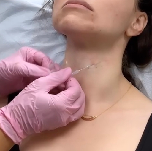 Explore early miscarriage tattoo ideas, creative tattoo ideas in Lake Oswego, available at Lake Oswego Vein and Aesthetic LOVA