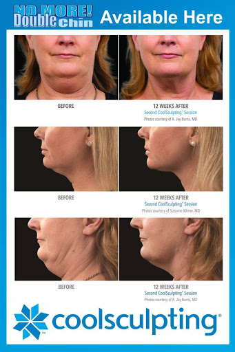 Explore shoulder cap tattoo ideas, creative tattoo ideas in Bothell, available at Mill Creek Skin & Laser Center - Medspa
