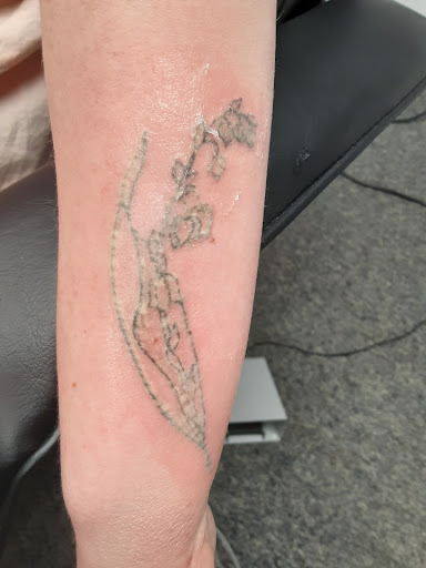 Explore rose tattoo ideas forearm, creative tattoo ideas in Saint Paul, available at Fearless Tattoo Removal