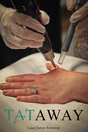 Explore corvette tattoo ideas, creative tattoo ideas in Boston, available at Removery Tattoo Removal & Fading