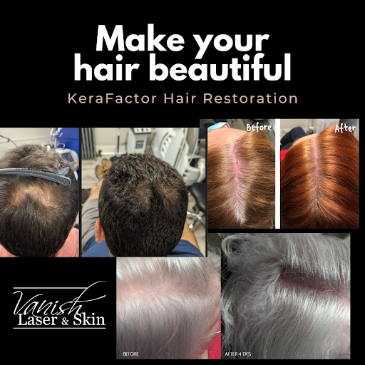Explore tattoo ideas for older ladies, creative tattoo ideas in Williamsport, available at Vanish Laser & Skin, Inc.