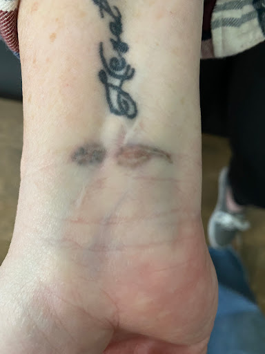 Explore dobby tattoo ideas, creative tattoo ideas in Lake Jackson, available at Second Chance Laser Tattoo Removal