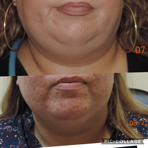 Medical Spa «New Image Medical Spa», reviews and photos, 680 Mowry Ave, Fremont, CA 94536, USA