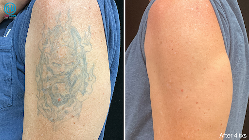 Explore tattoo ideas for military, creative tattoo ideas in Westminster, available at Newhope Laser Skin Care