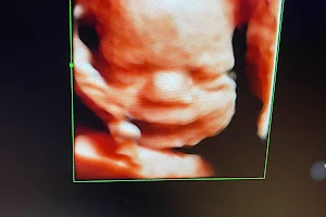 Baby Meets World 3D/4D HD Live Ultrasound Studio and Boutique image