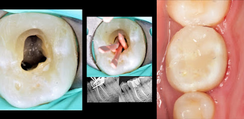Endodoncia Especializada - Dr Raul Navarro