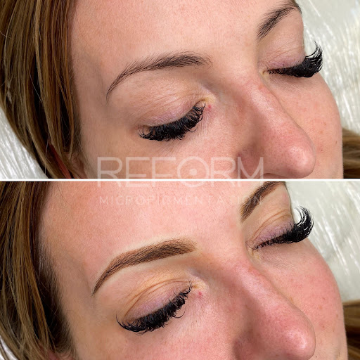 Reform Micropigmentation