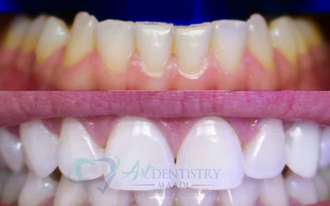 Art Dentistry Maadi | Dr Islam Shalash Clinic image