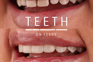Teeth on Ferry image