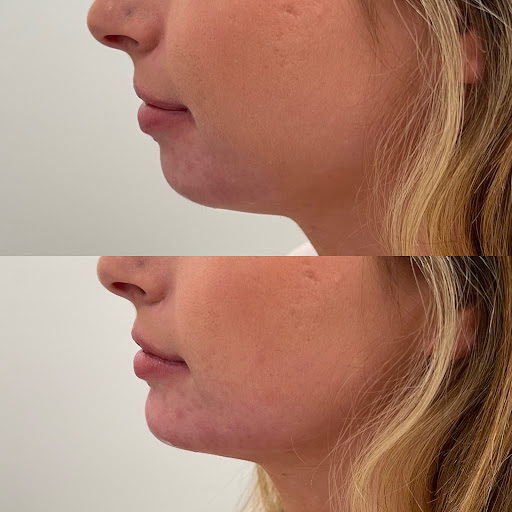 Explore teenage tattoo ideas, creative tattoo ideas in Owensboro, available at The Skin Lab