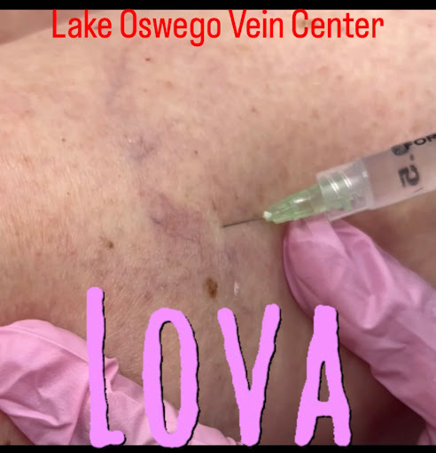 Explore protective tattoo ideas, creative tattoo ideas in Lake Oswego, available at Lake Oswego Vein and Aesthetic LOVA