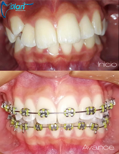 Molart. Odontología Integral - Dentista