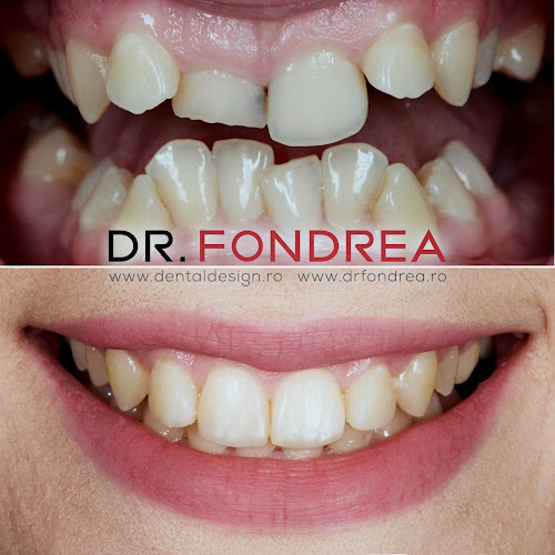 Opinii despre Dr. Fondrea - stomatologie, implantologie, estetica dentara în <nil> - Dentist
