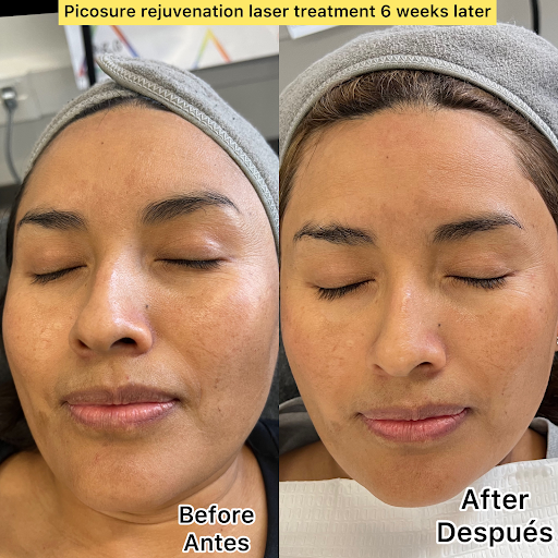 Explore farm tattoos ideas, creative tattoo ideas in New York, available at Ag2g Laser Tattoo Removal & MedSpa