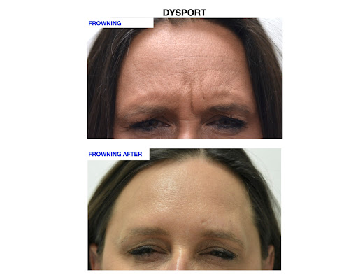 Explore rose and butterfly tattoo ideas, creative tattoo ideas in Chino, available at SoCal Body Institute