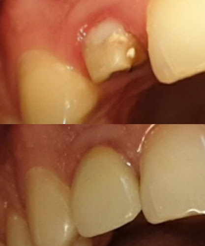 CMI Dr. Pantelimon - Dentist