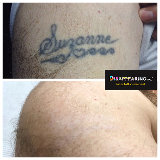 Explore patchwork sleeve tattoo ideas, creative tattoo ideas in Lawrence, available at Removery Tattoo Removal & Fading