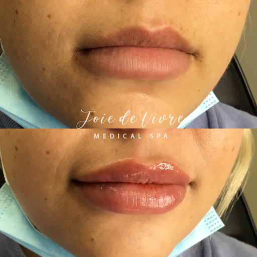 Explore opposites tattoo ideas, creative tattoo ideas in Canton, available at JDV Med Spa