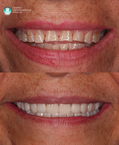 Centro Odontológico Rosales - Dentista