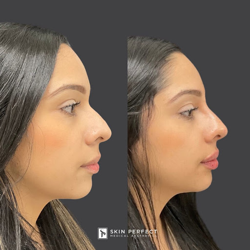 Explore catrina tattoo ideas, creative tattoo ideas in Whittier, available at Skin Perfect Medical Aesthetics