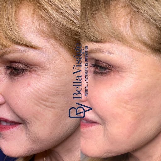 Explore irish cross tattoo ideas, creative tattoo ideas in Lakeland, available at Bella Visge Medical & Aesthetic Rejuvenation