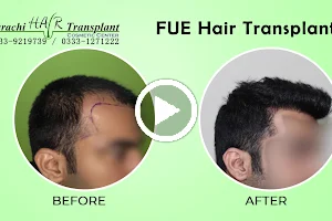 Karachi Hair Transplant Clinic image