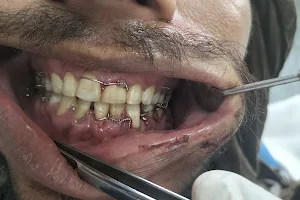 Ghauri Dental And Oral & Maxillofacial Surgery Clinic. Dr. Nouman Ghauri. BDS .FCPS(OMFS) image