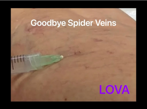 Explore inner peace tattoo ideas, creative tattoo ideas in Lake Oswego, available at Lake Oswego Vein and Aesthetic LOVA