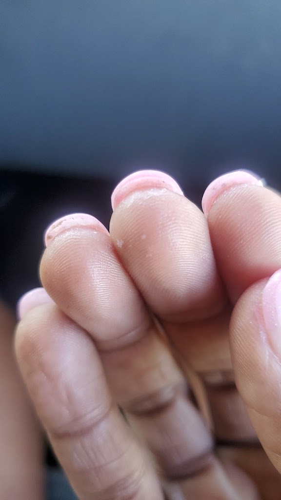 Q Nail 78045