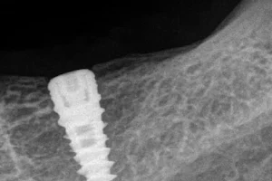 Shubham Dental & Implant Clinic image